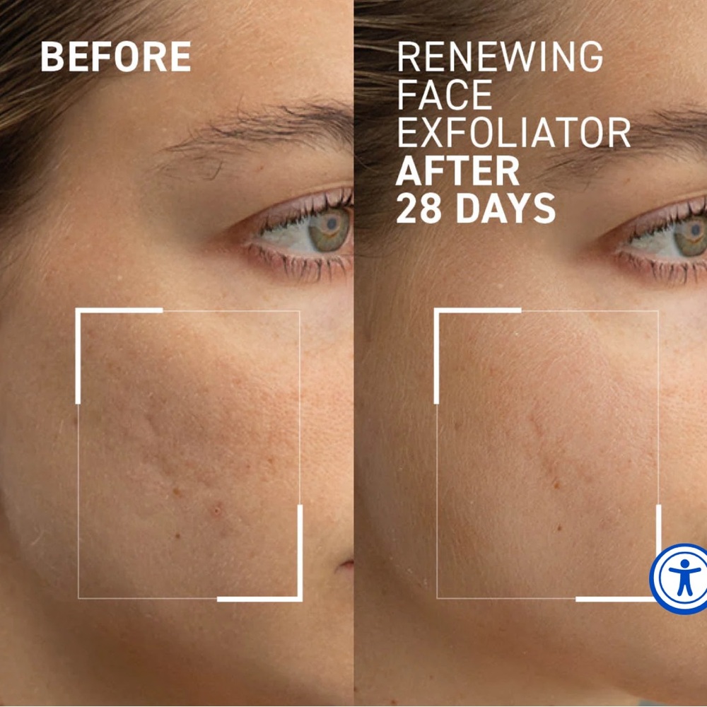 DR.BRANDT Micro dermabrasion - Picture 3 of 4